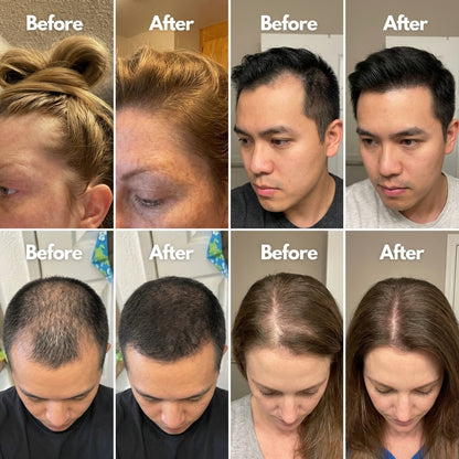 Newplum 01: Follicle Growth Roll-On