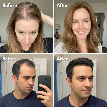 Newplum 01: Follicle Growth Roll-On