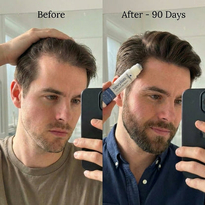 Newplum: Advanced Hair Growth Roll - On Serum - Newplum