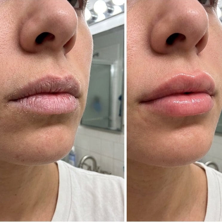 Newplum: Peel — Cooling Lip Prep Mask Buy 3, Get 2 Free - Newplum
