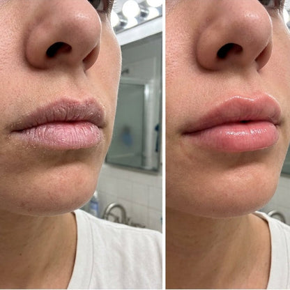 Newplum: Peel — Cooling Lip Prep Mask Buy 3, Get 2 Free - Newplum