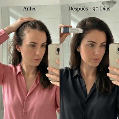 Newplum: Sérum Roll - On Avanzado para el Crecimiento del Cabello - Newplum